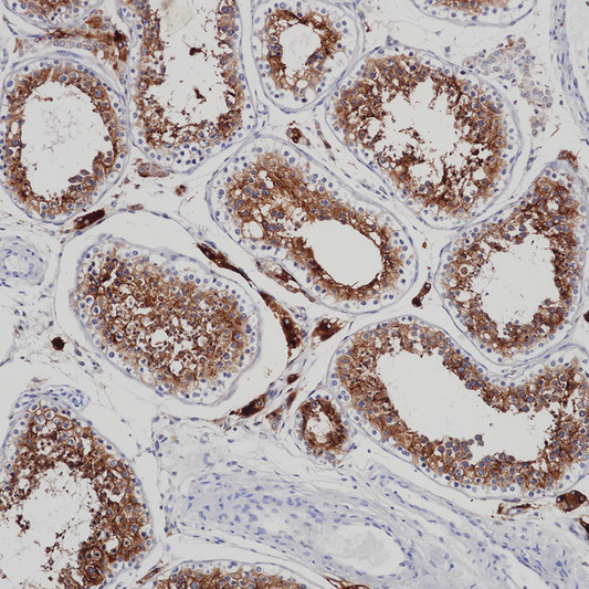ACE2 antibody immunohistochemistry paraffin-embedded testis tissue STJA0037680