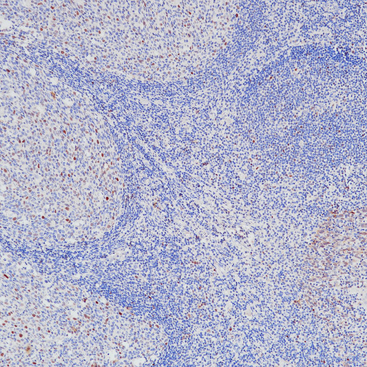 c-Myc antibody immunohistochemistry tonsil STJA0037700
