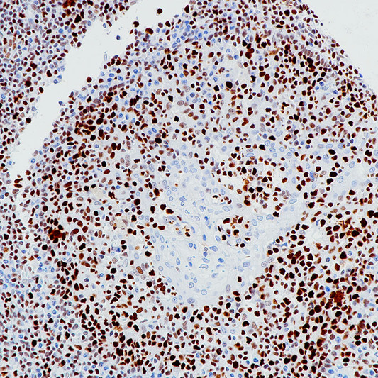 MCM2 antibody immunohistochemistry paraffin-embedded tonsil STJA0037717