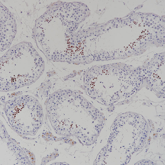 NUT antibody immunohistochemistry testis paraffin-embedded STJA0037718