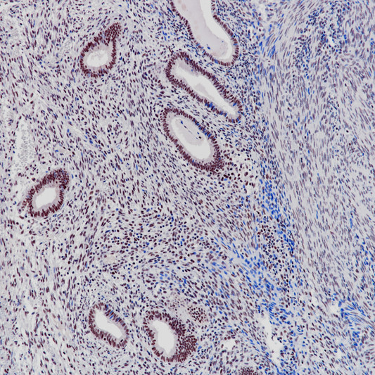 E2F4 antibody immunohistochemistry paraffin-embedded endometrial tissue STJA0037740