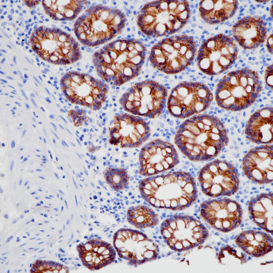 LI Cadherin antibody immunohistochemistry colon paraffin-embedded STJA0037747