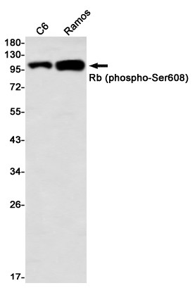 Phospho-Rb Ser608 antibody western blot C6 Ramos STJA0035092