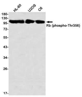 Phospho-Rb Thr356 antibody western blot HL-60 U2OS C6 STJA0035095