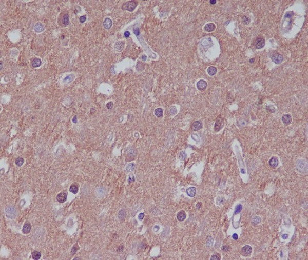 Substance P antibody immunohistochemistry human brain paraffin-embedded STJA0035456