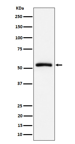 CAP1 antibody western blot Raji lysates STJA0035556