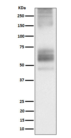 Somatostatin Receptor 1 antibody western blot 293T STJA0035580