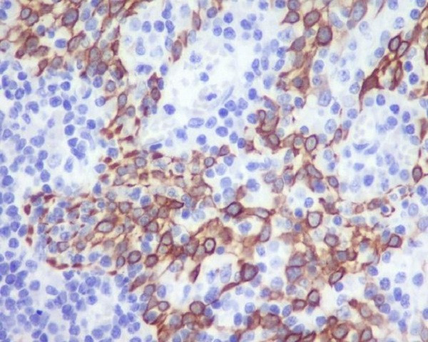 CCR2/CKR2 antibody immunohistochemistry human tonsil STJA0035751