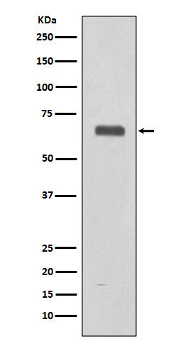 Complement C9 antibody western blot human fetal liver STJA0035813