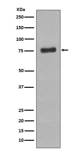 Phospho-BTK antibody western blot Raji lysates STJA0035963