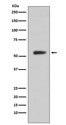 CA9 antibody western blot human stomach STJA0035982