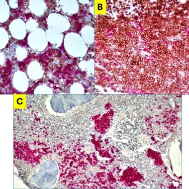 Anti-BONE MARROW COCKTAIL antibody IHC normal human bone marrow STJ180692