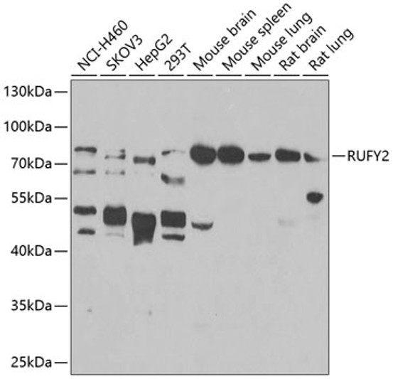 Western blot analysis of various lysates using RUFY2 Rabbit pAb (STJ110290) at 1:1000 dilution. <br/>Secondary antibody: HRP-conjugated Goat anti-Rabbit IgG (H+L) (STJS000856) at 1:10000 dilution. <br/>Lysates/proteins: 25 Mu g per lane. <br/>Blocking buffer: 3% nonfat dry milk in TBST. <br/>Detection: ECL Enhanced Kit <br/>Exposure time: 90s.