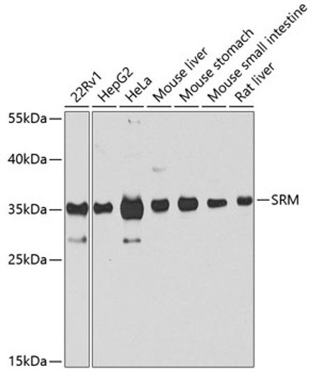 Western blot analysis of various lysates using S <br/>Secondary antibody: HRP-conjugated Goat anti-Rabbit IgG (H+L) (STJS000856) at 1:10000 dilution. <br/>Lysates/proteins: 25 Mu g per lane. <br/>Blocking buffer: 3% nonfat dry milk in TBST. <br/>Detection: ECL Basic Kit <br/>Exposure time: 10s. Western blot analysis of various lysates using S <br/>Secondary antibody: HRP-conjugated Goat anti-Rabbit IgG (H+L) (STJS000856) at 1:10000 dilution. <br/>Lysates/proteins: 25 Mu g per lane. <br/>Blocking buffer: 3% nonfat dry milk in TBST. <br/>Detection: ECL Basic Kit <br/>Exposure time: 10s.