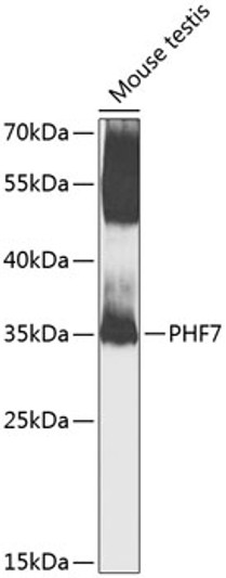 Western blot analysis of lysates from mouse testis, using PHF7 Rabbit pAb (STJ110517) at 1:1000 dilution. <br/>Secondary antibody: HRP-conjugated Goat anti-Rabbit IgG (H+L) (STJS000856) at 1:10000 dilution. <br/>Lysates/proteins: 25 Mu g per lane. <br/>Blocking buffer: 3% nonfat dry milk in TBST. <br/>Detection: ECL Basic Kit <br/>Exposure time: 90s.