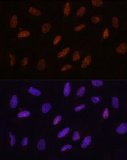 Immunofluorescence analysis of U2OS cells using TET3 Rabbit polyclonal antibody (STJ11100275) at dilution of 1:100. Secondary antibody: Cy3 Goat Anti-Rabbit IgG (H+L) at 1:500 dilution. Blue: DAPI for nuclear staining.