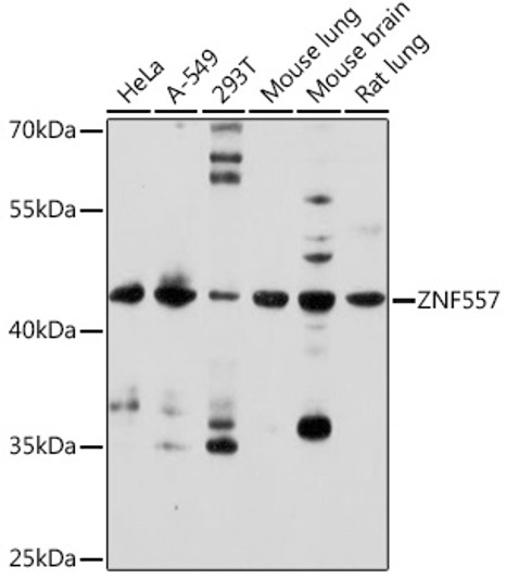 Western blot analysis of various lysates using ZNF557 Rabbit pAb (STJ11100444) at 1:500 dilution. <br/>Secondary antibody: HRP-conjugated Goat anti-Rabbit IgG (H+L) (STJS000856) at 1:10000 dilution. <br/>Lysates/proteins: 25 Mu g per lane. <br/>Blocking buffer: 3% nonfat dry milk in TBST. <br/>Detection: ECL Enhanced Kit <br/>Exposure time: 180s. Western blot analysis of various lysates using ZNF557 Rabbit pAb (STJ11100444) at 1:500 dilution. <br/>Secondary antibody: HRP-conjugated Goat anti-Rabbit IgG (H+L) (STJS000856) at 1:10000 dilution. <br/>Lysates/proteins: 25 Mu g per lane. <br/>Blocking buffer: 3% nonfat dry milk in TBST. <br/>Detection: ECL Enhanced Kit <br/>Exposure time: 180s.