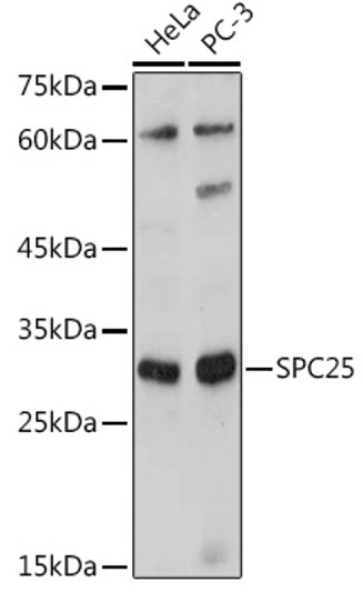 Western blot analysis of extracts of various cell lines, using SPC25 antibody (STJ11101163) at 1:1000 dilution. Secondary antibody: HRP Goat Anti-Rabbit IgG (H+L) (STJS000856) at 1:10000 dilution. Lysates/proteins: 25 Mu g per lane. Blocking buffer: 3% nonfat dry milk in TBST. Detection: ECL Basic Kit. Exposure time: 180s.
