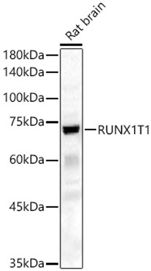 Western blot analysis of Rat brain, using RUNX1T1 antibody (STJ111109) at 1:600 dilution. Secondary antibody: HRP Goat Anti-Rabbit IgG (H+L) (STJS000856) at 1:10000 dilution. Lysates/proteins: 25 Mu g per lane. Blocking buffer: 3% nonfat dry milk in TBST. Detection: ECL Basic Kit. Exposure time: 60s.