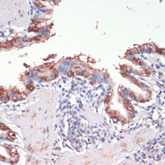 Immunohistochemistry analysis of paraffin-embedded rat lung using Musashi-1 (Musashi-1 (MSI1) ) antibody (STJ111162) at dilution of 1:200 (40x lens). Perform microwave antigen retrieval with 10 mM PBS buffer pH 7. 2 before commencing with immunohistochemistry staining protocol.