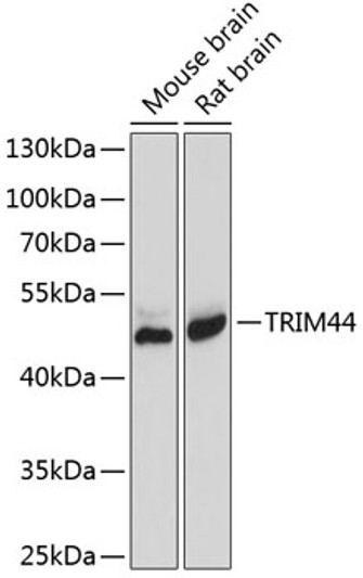 Western blot analysis of various lysates using TRIM44 Rabbit pAb (STJ111387) at 1:1000 dilution. <br/>Secondary antibody: HRP-conjugated Goat anti-Rabbit IgG (H+L) (STJS000856) at 1:10000 dilution. <br/>Lysates/proteins: 25 Mu g per lane. <br/>Blocking buffer: 3% nonfat dry milk in TBST. <br/>Detection: ECL Basic Kit <br/>Exposure time: 30s.