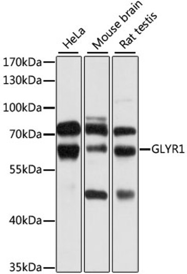 Western blot analysis of various lysates using GLYR1 Rabbit pAb (STJ111541) at 1:1000 dilution. <br/>Secondary antibody: HRP-conjugated Goat anti-Rabbit IgG (H+L) (STJS000856) at 1:10000 dilution. <br/>Lysates/proteins: 25 Mu g per lane. <br/>Blocking buffer: 3% nonfat dry milk in TBST. <br/>Detection: ECL Basic Kit <br/>Exposure time: 5s.
