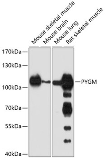 Western blot analysis of various lysates using PYGM Rabbit pAb (STJ111685) at 1:1000 dilution. <br/>Secondary antibody: HRP-conjugated Goat anti-Rabbit IgG (H+L) (STJS000856) at 1:10000 dilution. <br/>Lysates/proteins: 25 Mu g per lane. <br/>Blocking buffer: 3% nonfat dry milk in TBST. <br/>Detection: ECL Basic Kit <br/>Exposure time: 90s.