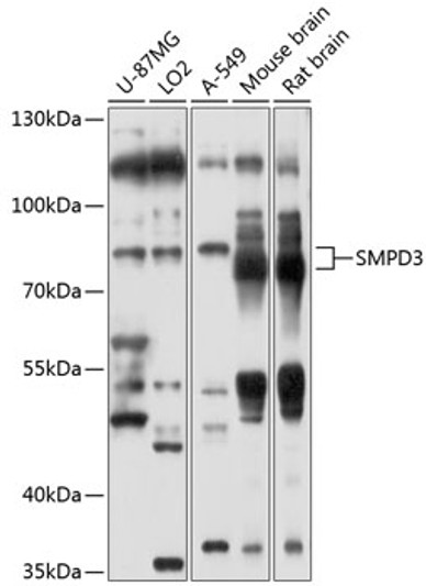 Western blot analysis of extracts of various cell lines, using SMPD3 antibody (STJ112235) at 1:1000 dilution. Secondary antibody: HRP Goat Anti-Rabbit IgG (H+L) (STJS000856) at 1:10000 dilution. Lysates/proteins: 25 Mu g per lane. Blocking buffer: 3% nonfat dry milk in TBST. Detection: ECL Basic Kit. Exposure time: 10s.