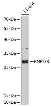Western blot analysis of extracts of BT-474 cells, using RNF138 antibody (STJ112342) at 1:1000 dilution. Secondary antibody: HRP Goat Anti-Rabbit IgG (H+L) (STJS000856) at 1:10000 dilution. Lysates/proteins: 25 Mu g per lane. Blocking buffer: 3% nonfat dry milk in TBST. Detection: ECL Basic Kit. Exposure time: 90s.