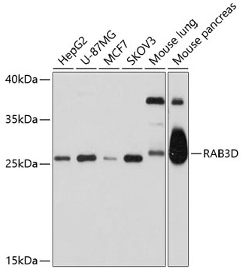 Western blot analysis of extracts of various cell lines, using RAB3D antibody (STJ112426) at 1:1000 dilution. Secondary antibody: HRP Goat Anti-Rabbit IgG (H+L) (STJS000856) at 1:10000 dilution. Lysates/proteins: 25 Mu g per lane. Blocking buffer: 3% nonfat dry milk in TBST. Detection: ECL Basic Kit. Exposure time: 30s.