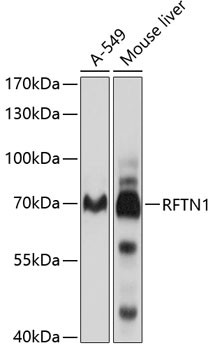 Western blot analysis of various lysates using RFTN1 Rabbit pAb (STJ112462) at 1:1000 dilution. <br/>Secondary antibody: HRP-conjugated Goat anti-Rabbit IgG (H+L) (STJS000856) at 1:10000 dilution. <br/>Lysates/proteins: 25 Mu g per lane. <br/>Blocking buffer: 3% nonfat dry milk in TBST. <br/>Detection: ECL Basic Kit <br/>Exposure time: 5s.