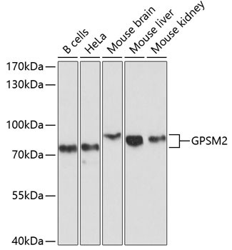 Western blot analysis of various lysates using GPSM2 Rabbit polyclonal antibody (STJ112571) at 1:1000 dilution. Secondary antibody: HRP Goat Anti-Rabbit IgG (H+L) (STJS000856) at 1:10000 dilution. Lysates/proteins: 25 Mu g per lane. Blocking buffer: 3% nonfat dry milk in TBST. Detection: ECL Basic Kit. Exposure time: 10s.