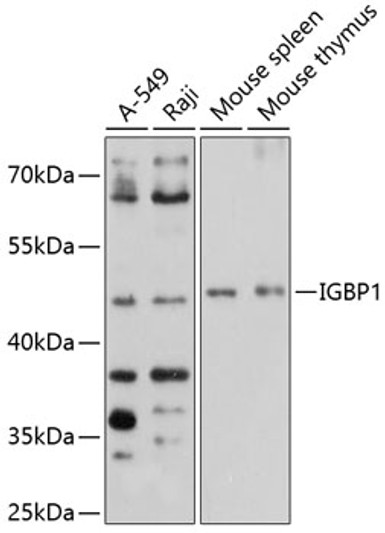 Western blot analysis of various lysates using IGBP1 Rabbit pAb (STJ112732) at 1:1000 dilution. <br/>Secondary antibody: HRP-conjugated Goat anti-Rabbit IgG (H+L) (STJS000856) at 1:10000 dilution. <br/>Lysates/proteins: 25 Mu g per lane. <br/>Blocking buffer: 3% nonfat dry milk in TBST. <br/>Detection: ECL Basic Kit <br/>Exposure time: 40s.