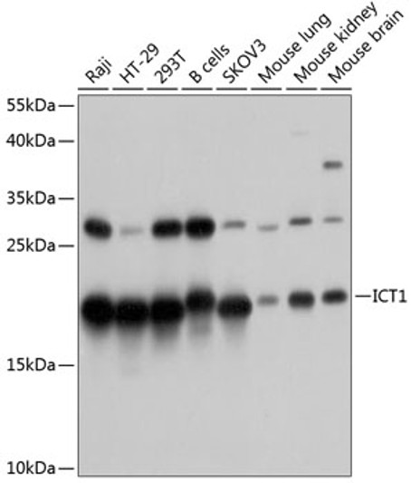 Western blot analysis of various lysates using ICT1 Rabbit polyclonal antibody (STJ113195) at 1:1000 dilution. Secondary antibody: HRP Goat Anti-Rabbit IgG (H+L) (STJS000856) at 1:10000 dilution. Lysates/proteins: 25 Mu g per lane. Blocking buffer: 3% nonfat dry milk in TBST. Detection: ECL Basic Kit. Exposure time: 5s.