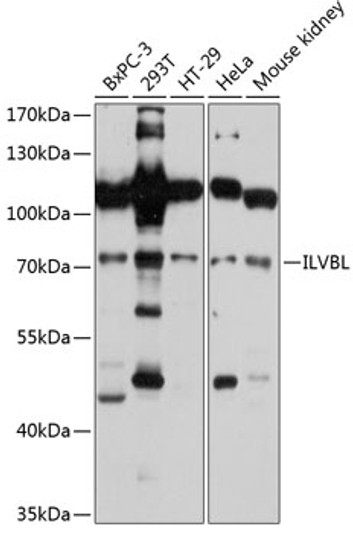 Western blot analysis of various lysates using ILVBL Rabbit pAb (STJ113229) at 1:3000 dilution. <br/>Secondary antibody: HRP-conjugated Goat anti-Rabbit IgG (H+L) (STJS000856) at 1:10000 dilution. <br/>Lysates/proteins: 25 Mu g per lane. <br/>Blocking buffer: 3% nonfat dry milk in TBST. <br/>Detection: ECL Basic Kit <br/>Exposure time: 5s.