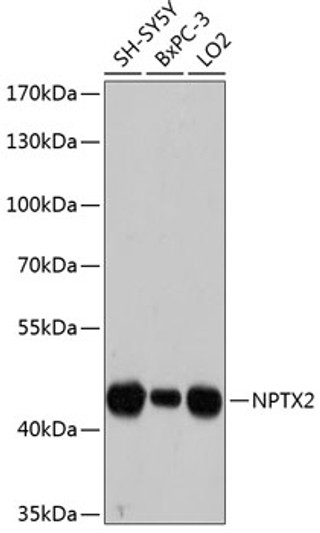 Western blot analysis of various lysates using NPTX2 Rabbit polyclonal antibody (STJ113932) at 1:3000 dilution. Secondary antibody: HRP Goat Anti-Rabbit IgG (H+L) (STJS000856) at 1:10000 dilution. Lysates/proteins: 25 Mu g per lane. Blocking buffer: 3% nonfat dry milk in TBST. Detection: ECL Basic Kit. Exposure time: 60s.