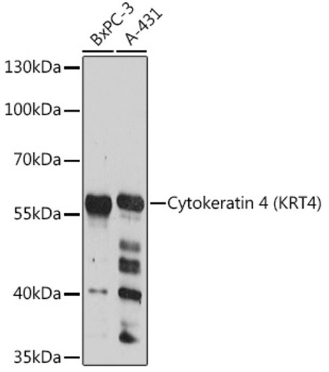 Western blot analysis of various lysates using Cytokeratin 4 (KRT4) Rabbit pAb (STJ114049) at 1:3000 dilution. <br/>Secondary antibody: HRP-conjugated Goat anti-Rabbit IgG (H+L) (STJS000856) at 1:10000 dilution. <br/>Lysates/proteins: 25 Mu g per lane. <br/>Blocking buffer: 3% nonfat dry milk in TBST. <br/>Detection: ECL Basic Kit <br/>Exposure time: 15s.