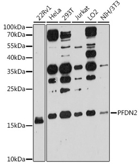 Western blot analysis of various lysates using PFDN2 Rabbit polyclonal antibody (STJ114159) at 1:3000 dilution. Secondary antibody: HRP Goat Anti-Rabbit IgG (H+L) (STJS000856) at 1:10000 dilution. Lysates/proteins: 25 Mu g per lane. Blocking buffer: 3% nonfat dry milk in TBST. Detection: ECL Basic Kit. Exposure time: 90s.