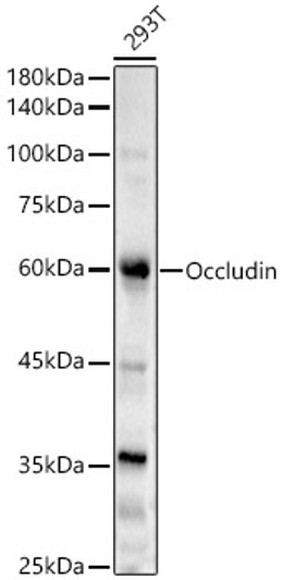 Western blot analysis of 293T, using Occludin antibody (STJ114495) at 1:2000 dilution. Secondary antibody: HRP Goat Anti-Rabbit IgG (H+L) (STJS000856) at 1:10000 dilution. Lysates/proteins: 25 Mu g per lane. Blocking buffer: 3% nonfat dry milk in TBST. Detection: ECL Basic Kit. Exposure time: 5s.