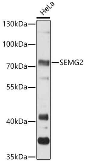 Western blot analysis of lysates from HeLa cells, using SEMG2 Rabbit polyclonal antibody (STJ114692) at 1:3000 dilution. Secondary antibody: HRP Goat Anti-Rabbit IgG (H+L) (STJS000856) at 1:10000 dilution. Lysates/proteins: 25 Mu g per lane. Blocking buffer: 3% nonfat dry milk in TBST. Detection: ECL Basic Kit. Exposure time: 30s.