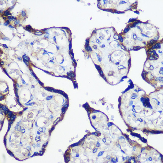 Immunohistochemistry analysis of PARP8 in paraffin-embedded Human placenta using PARP8 Rabbit polyclonal antibody (STJ114760) at dilution of 1:100 (40x lens). Perform microwave antigen retrieval with 10 mM PBS buffer pH 7. 2 before commencing with immunohistochemistry staining protocol. Immunohistochemistry analysis of PARP8 in paraffin-embedded Human placenta using PARP8 Rabbit polyclonal antibody (STJ114760) at dilution of 1:100 (40x lens). Perform microwave antigen retrieval with 10 mM PBS buffer pH 7. 2 before commencing with immunohistochemistry staining protocol.