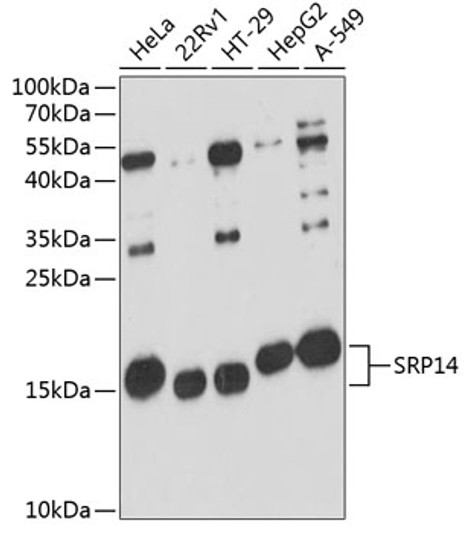 Western blot analysis of various lysates using SRP14 Rabbit polyclonal antibody (STJ114792) at 1:3000 dilution. Secondary antibody: HRP Goat Anti-Rabbit IgG (H+L) (STJS000856) at 1:10000 dilution. Lysates/proteins: 25 Mu g per lane. Blocking buffer: 3% nonfat dry milk in TBST. Detection: ECL Basic Kit. Exposure time: 90s.