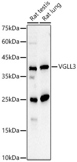 Western blot analysis of various lysates, using VGLL3 rabbit polyclonal antibody (STJ115228) at 1:2000 dilution. Secondary antibody: HRP Goat Anti-rabbit IgG (H+L) (STJS000856) at 1:10000 dilution. Lysates/proteins: 25ug per lane. Blocking buffer: 3% non-fat dry milk in TBST. Detection: ECL Basic Kit. Exposure time: 30s. Western blot analysis of various lysates, using VGLL3 rabbit polyclonal antibody (STJ115228) at 1:2000 dilution. Secondary antibody: HRP Goat Anti-rabbit IgG (H+L) (STJS000856) at 1:10000 dilution. Lysates/proteins: 25ug per lane. Blocking buffer: 3% non-fat dry milk in TBST. Detection: ECL Basic Kit. Exposure time: 30s.