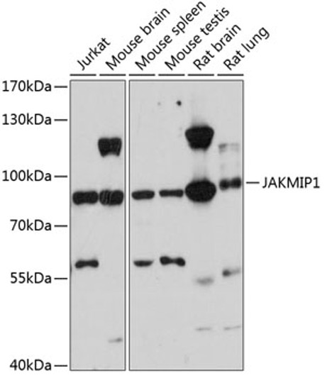 Western blot analysis of various lysates using JAKMIP1 Rabbit pAb (STJ115719) at 1:3000 dilution. <br/>Secondary antibody: HRP-conjugated Goat anti-Rabbit IgG (H+L) (STJS000856) at 1:10000 dilution. <br/>Lysates/proteins: 25 Mu g per lane. <br/>Blocking buffer: 3% nonfat dry milk in TBST. <br/>Detection: ECL Basic Kit <br/>Exposure time: 90s.