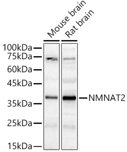 Western blot analysis of various lysates, using NMNAT2 antibody (STJ115774) at 1:400 dilution. Secondary antibody: HRP Goat Anti-Rabbit IgG (H+L) (STJS000856) at 1:10000 dilution. Lysates/proteins: 25 Mu g per lane. Blocking buffer: 3% nonfat dry milk in TBST. Detection: ECL Basic Kit. Exposure time: 180s.