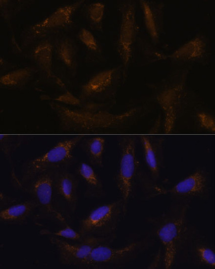 Immunofluorescence analysis of U-2 OS cells using SLC25A27 Rabbit polyclonal antibody (STJ115776) at dilution of 1:100. Secondary antibody: Cy3 Goat Anti-Rabbit IgG (H+L) at 1:500 dilution. Blue: DAPI for nuclear staining.