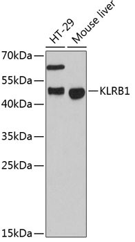 Western blot analysis of various lysates using KLRB1 Rabbit polyclonal antibody (STJ116310) at 1:3000 dilution. _Secondary antibody: HRP Goat Anti-Rabbit IgG (H+L) (STJS000856) at 1:10000 dilution. _Lysates/proteins: 25 Mu g per lane. _Blocking buffer: 3% nonfat dry milk in TBST. _Detection: ECL Enhanced Kit. _Exposure time: 90s.