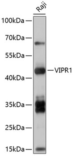 Western blot analysis of extracts of Raji cells, using VIPR1 antibody (STJ116410) at 1:1000 dilution. Secondary antibody: HRP Goat Anti-Rabbit IgG (H+L) (STJS000856) at 1:10000 dilution. Lysates/proteins: 25 Mu g per lane. Blocking buffer: 3% nonfat dry milk in TBST. Detection: ECL Basic Kit. Exposure time: 5s.