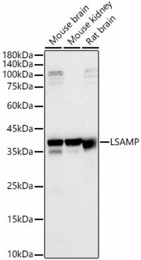 Western blot analysis of various lysates, using LSAMP antibody (STJ116461) at 1:1000 dilution. Secondary antibody: HRP Goat Anti-Rabbit IgG (H+L) (STJS000856) at 1:10000 dilution. Lysates/proteins: 25 Mu g per lane. Blocking buffer: 3% nonfat dry milk in TBST. Detection: ECL Basic Kit. Exposure time: 30s. Western blot analysis of various lysates, using LSAMP antibody (STJ116461) at 1:1000 dilution. Secondary antibody: HRP Goat Anti-Rabbit IgG (H+L) (STJS000856) at 1:10000 dilution. Lysates/proteins: 25 Mu g per lane. Blocking buffer: 3% nonfat dry milk in TBST. Detection: ECL Basic Kit. Exposure time: 30s.