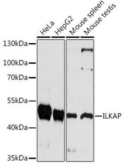 Western blot analysis of various lysates using ILKAP Rabbit polyclonal antibody (STJ116517) at 1:1000 dilution. Secondary antibody: HRP Goat Anti-Rabbit IgG (H+L) (STJS000856) at 1:10000 dilution. Lysates/proteins: 25 Mu g per lane. Blocking buffer: 3% nonfat dry milk in TBST. Detection: ECL Basic Kit. Exposure time: 30s.